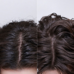 Moroccanoil Oily Scalp Tretman za masno teme